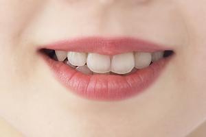 蒙古斑をレーザー治療をできるクリニック