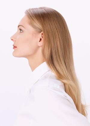 ボトックス注射を受けてみたい場合には